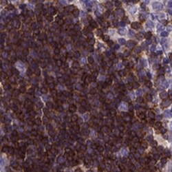 Themis Antibody, Novus Biologicals 0.1mL; Unlabeled:Antibodies, Polyclonal